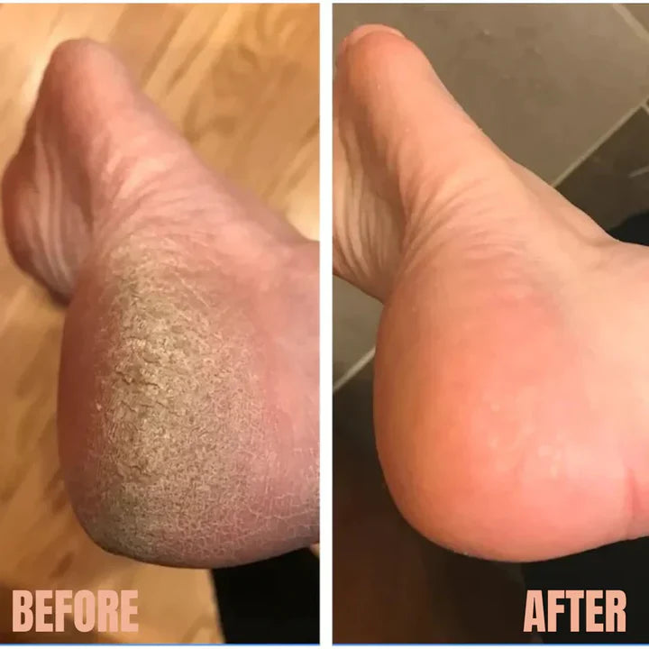Smooth Skin Electric Pedicure Tool